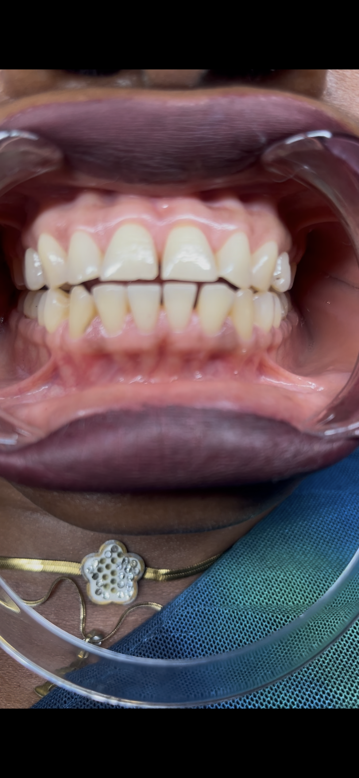 Dental profile verification